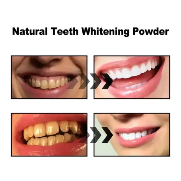 0265d936ccd19e944ff25cf887237462.jpg_720x720q80.jpg_ 100% Nature Activated Charcoal Teeth Whitening Powder